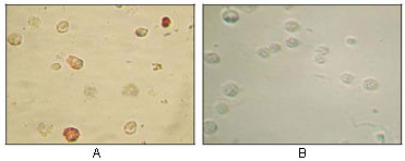 2 - KSHV ORF45 Antibody AO1016a