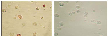 2 - KSHV ORF45 Antibody AO1016a