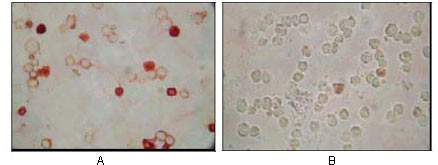 2 - KSHV ORF62 Antibody AO1017a