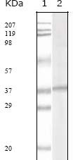 1 - KSHV ORF62 Antibody AO1017a