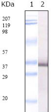 1 - SARS-E2 Antibody AO1018a