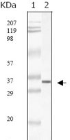 1 - SARS-M Antibody AO1019a