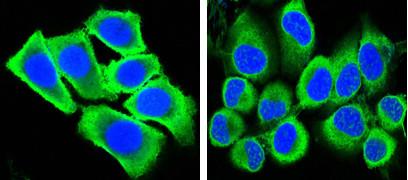 3 - KSHV ORF26 Antibody AO1034a