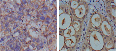 2 - KSHV ORF26 Antibody AO1034a