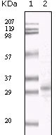 1 - KSHV ORF26 Antibody AO1034a