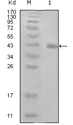 1 - E7 Antibody AO1208a