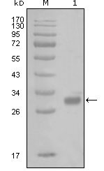 1 - PAR1 Antibody AO1214a