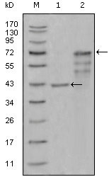 1 - CHIT1 Antibody AO1251a