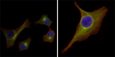 3 - KRT15 Antibody AO1335a