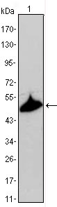 1 - KRT15 Antibody AO1335a