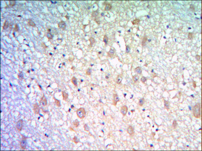 2 - KLHL21 Antibody AO1416a