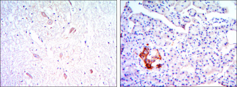 2 - KLHL13 Antibody AO1420a