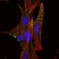 3 - KLHL1 Antibody AO1462a