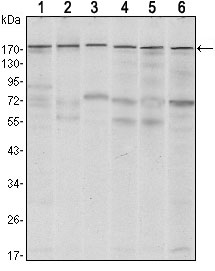 1 - SETDB1 Antibody AO1483a