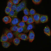 3 - SMN1 Antibody AO1572a