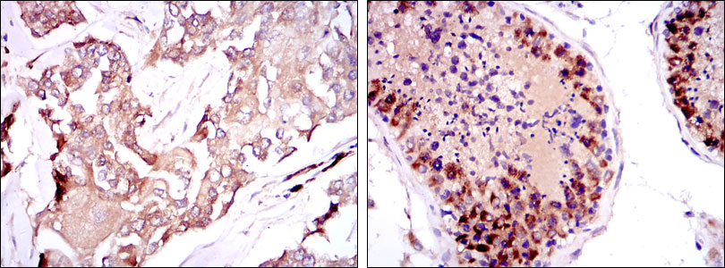 2 - SMN1 Antibody AO1572a