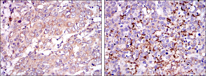 2 - SMN1 Antibody AO1572a