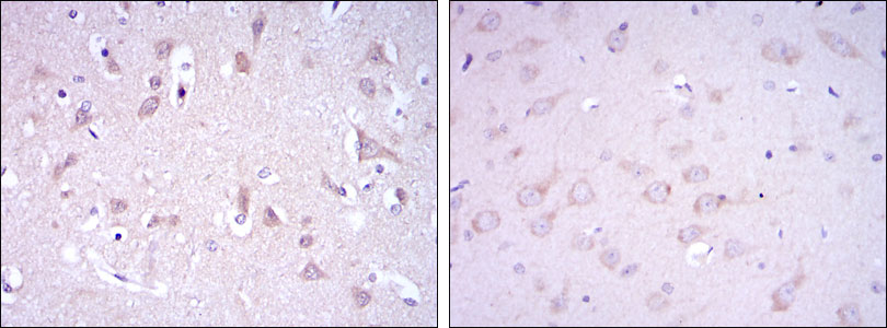 2 - GRIA3 Antibody AO1583a