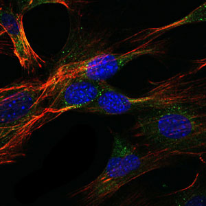 3 - GKAP Antibody AO1588a