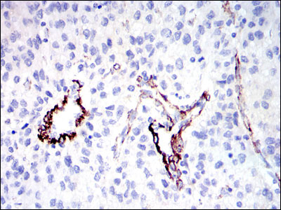 2 - GKAP Antibody AO1588a