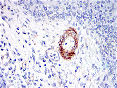 2 - GKAP Antibody AO1588a