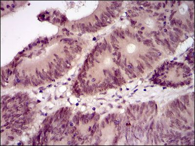 2 - mouse Lplunc1 Antibody AO1714a