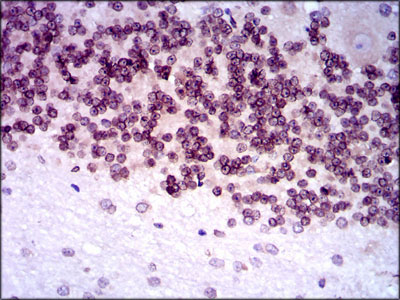2 - NR6A1 Antibody AO1742a