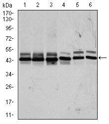 1 - CSNK2A2 Antibody AO1755a