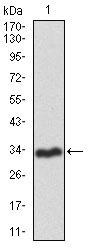 1 - RAG1 Antibody AO1762a