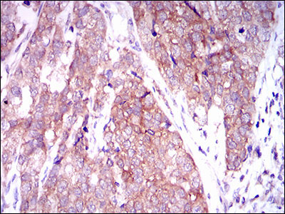 2 - MARK3 Antibody AO1766a