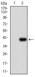 1 - ABCB1 Antibody AO1888a