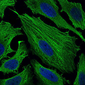 3 - SMCP Antibody AO1936a