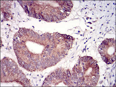 2 - TUBE1 Antibody AO1940a