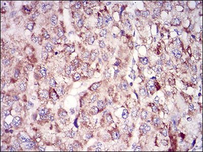 2 - TUBE1 Antibody AO1940a