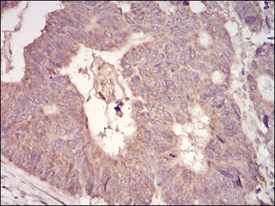 2 - MuRF1 Antibody AO1993a