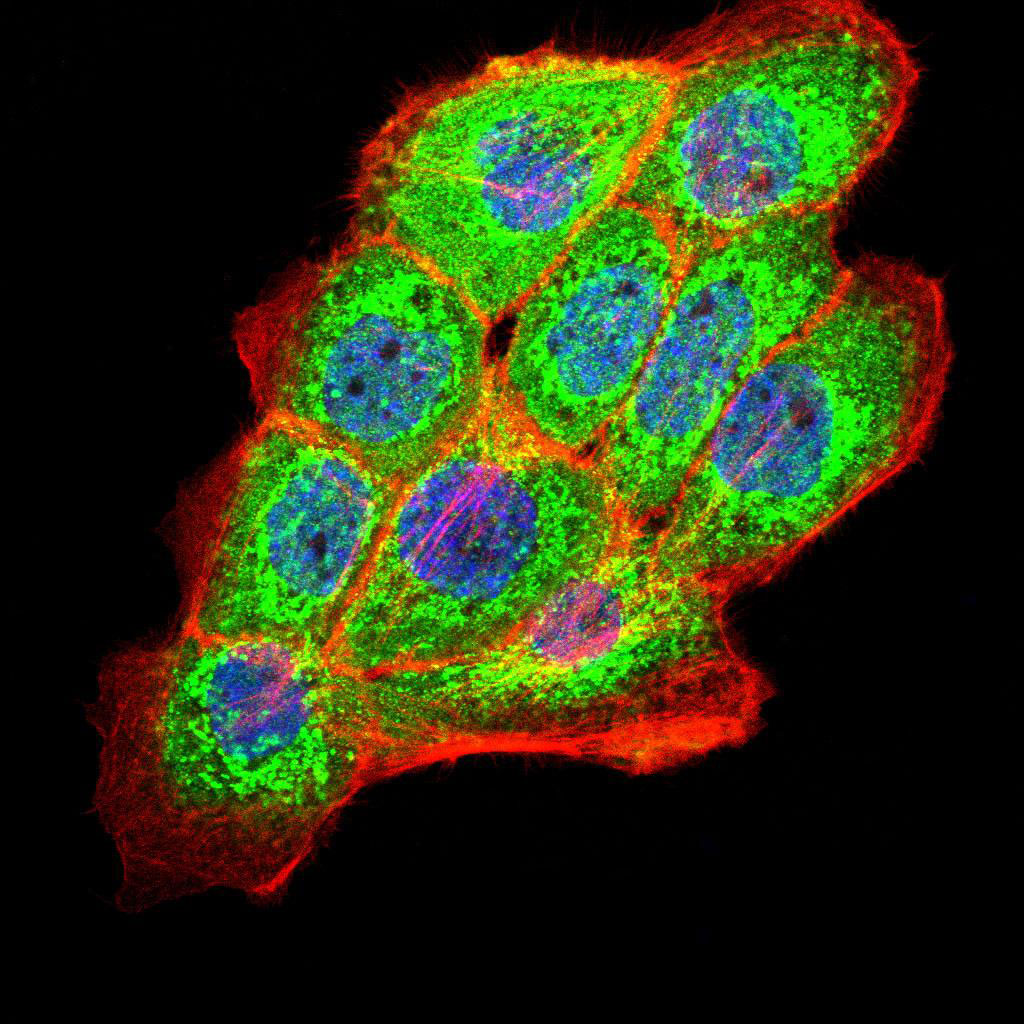 3 - PKHD1 Antibody AO2006a