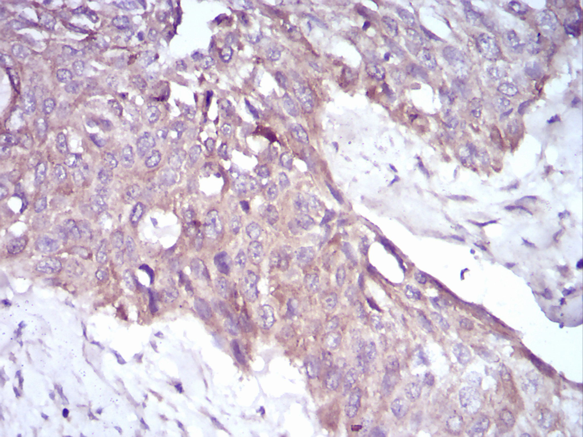 2 - PKHD1 Antibody AO2006a