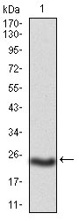 1 - PKHD1 Antibody AO2006a