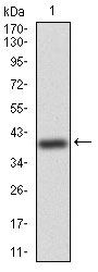 1 - WTAP Antibody AO2021a