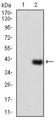 1 - WTAP Antibody AO2021a