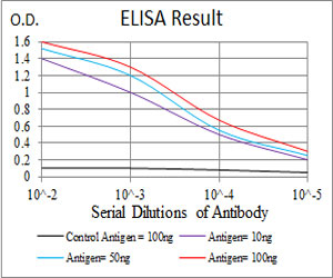 10 - KBTBD8 Antibody AO2031a