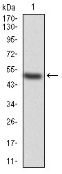 1 - KBTBD8 Antibody AO2031a