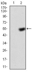 1 - KBTBD8 Antibody AO2031a