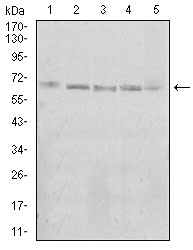 1 - KBTBD8 Antibody AO2031a