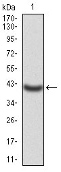 1 - KCND2 Antibody AO2036a