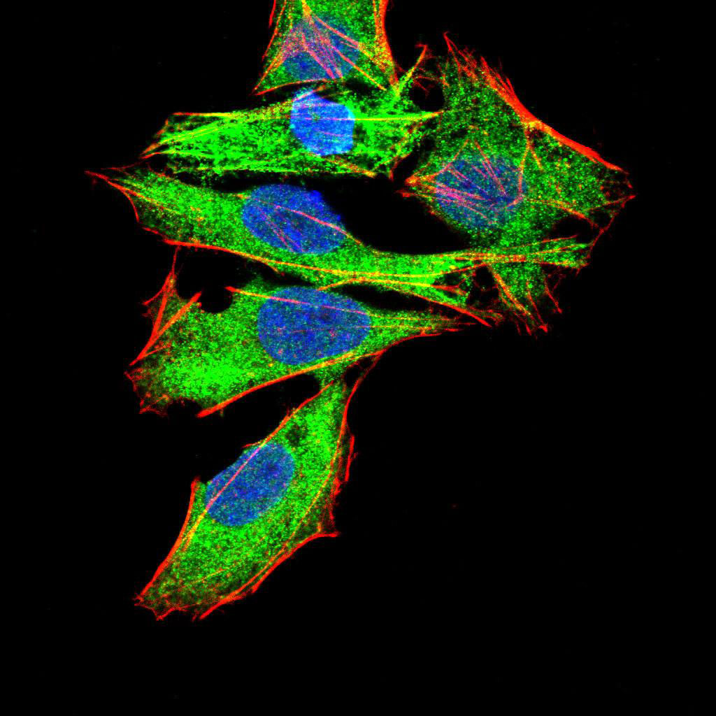 3 - GNAS Antibody AO2042a