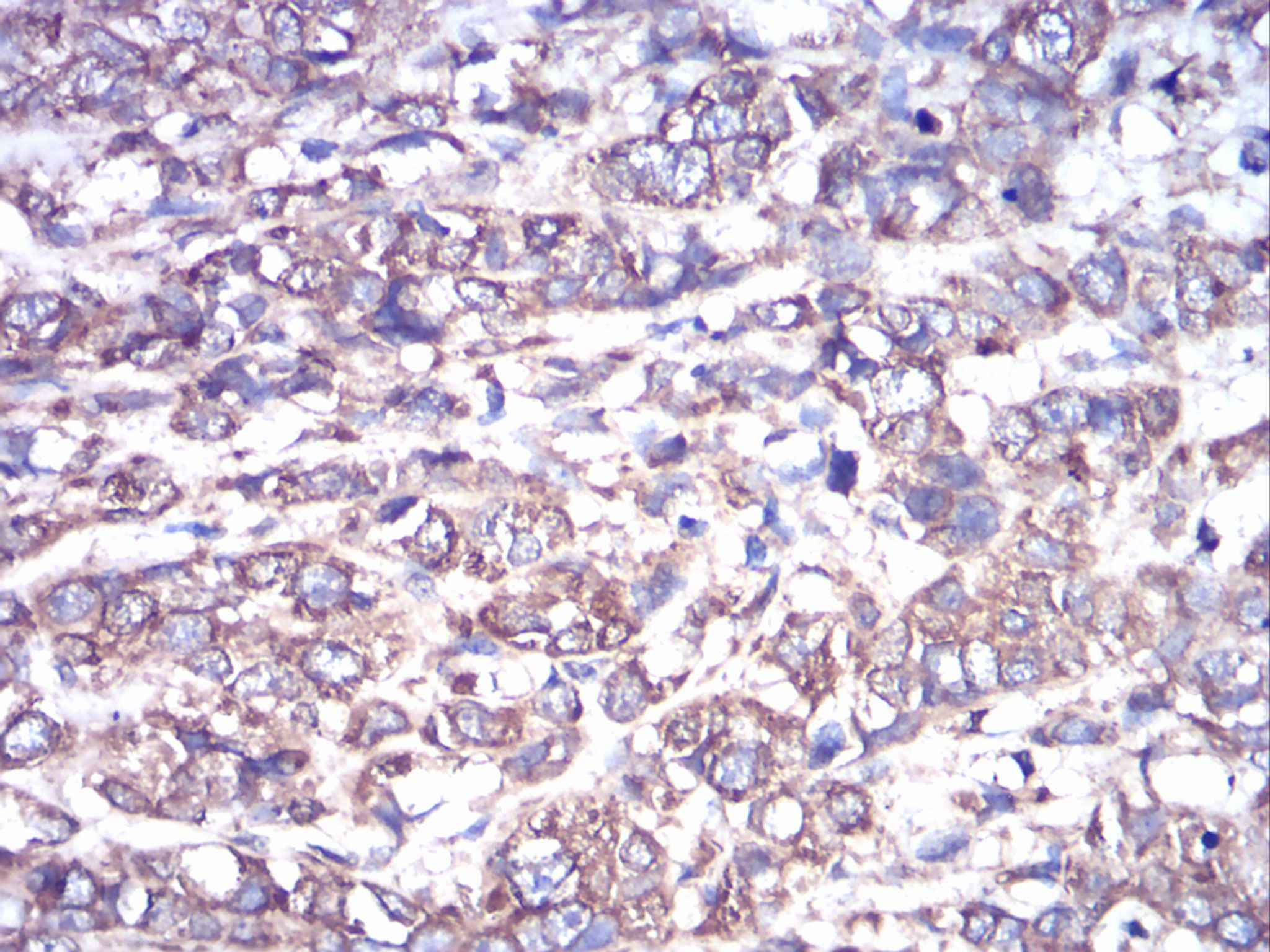 2 - GNAS Antibody AO2043a