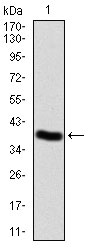 1 - WTAP Antibody AO2050a