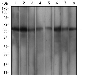 1 - WTAP Antibody AO2050a