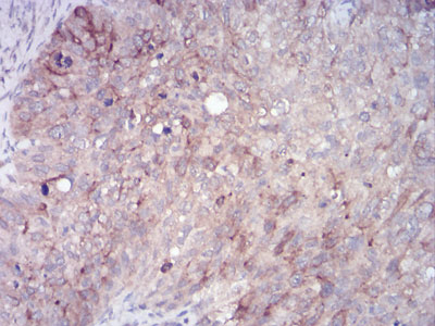2 - RAB11FIP1 Antibody AO2084a
